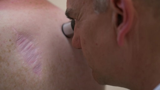 Ein Arzt untersucht die Haut eines Patienten auf Hautkrebs.